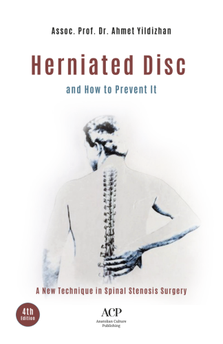 HERNIATED DISC